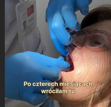  Opinie pacjentów